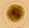 embryo